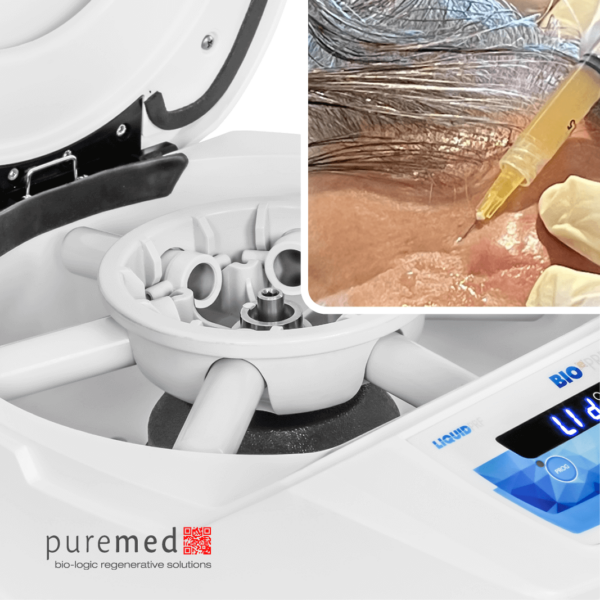 Facial Aesthetics PRF setup