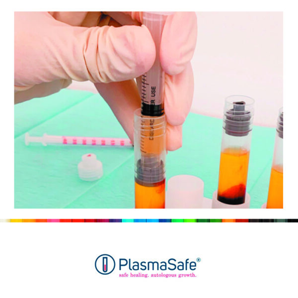 PS-6 PlasmaSafe (6 komplette kits til PRF ved sårbehandling, rør, stase, sprøjter)